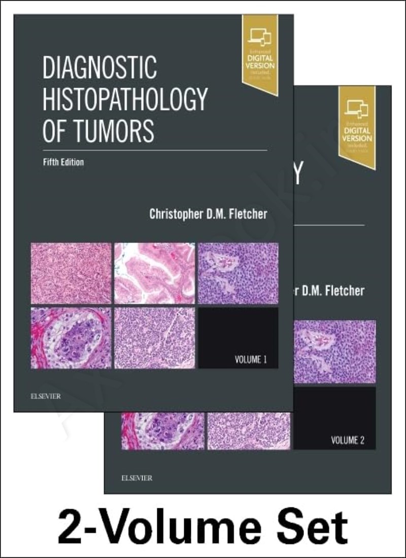 Diagnostic Histopathology of Tumors, 2 Volume Set Model.Title