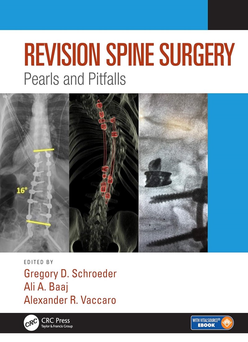 Revision Spine Surgery: Pearls and Pitfalls main 1 1