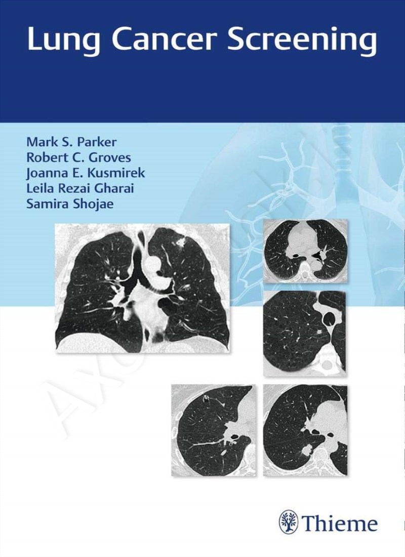 Lung Cancer Screening main 1 1