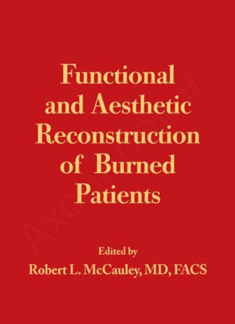 Functional and Aesthetic Reconstruction of Burned Patients main 1 1