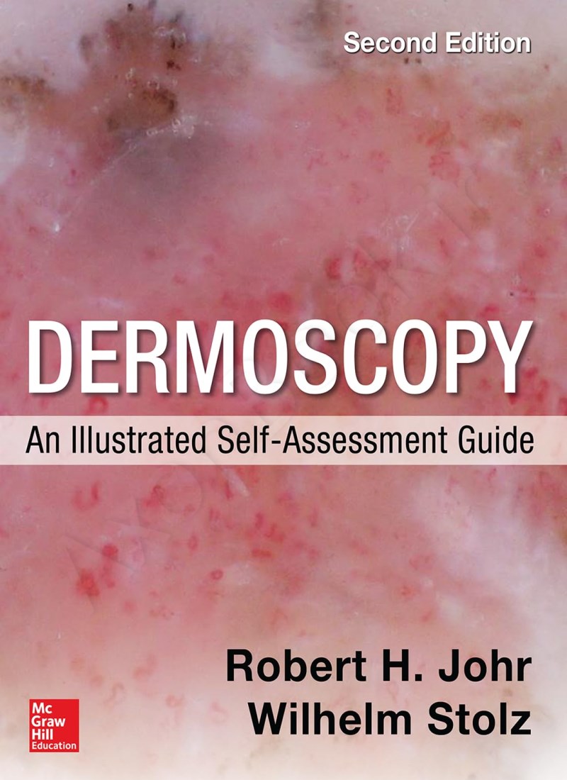 Dermoscopy: An Illustrated Self-Assessment Guide 2nd Edition main 1 1