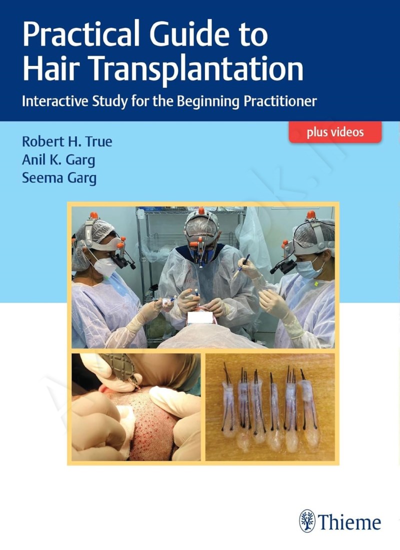 Practical Guide to Hair Transplantation: Interactive Study for the Beginning Practitioner main 1 1