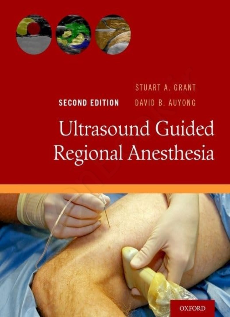 Ultrasound Guided Regional Anesthesia 2nd Edition main 1 1