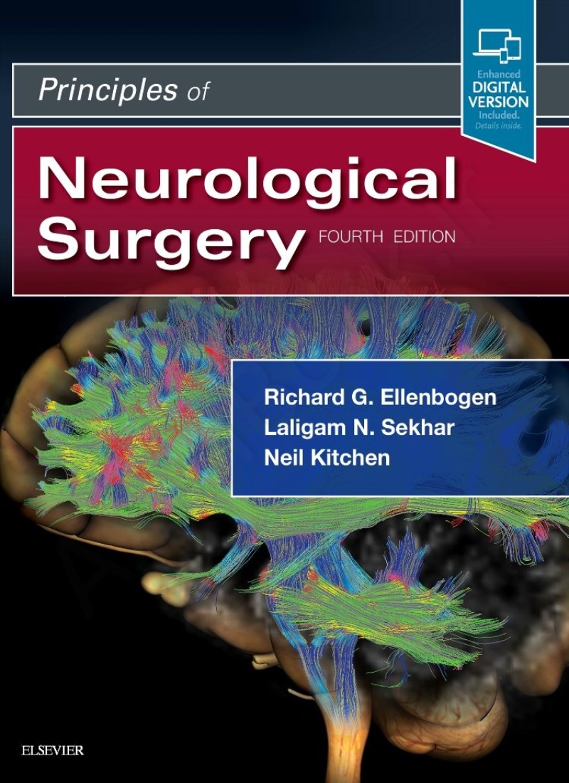 Principles of Neurological Surgery main 1 1