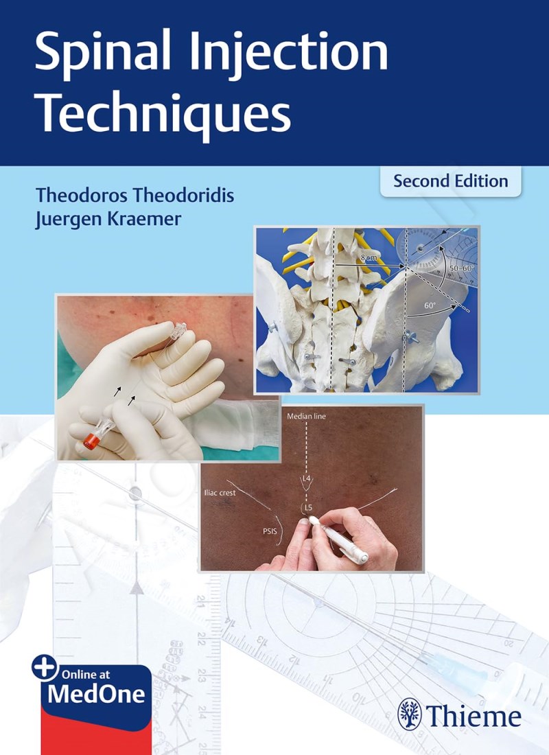 Spinal Injection Techniques main 1 1