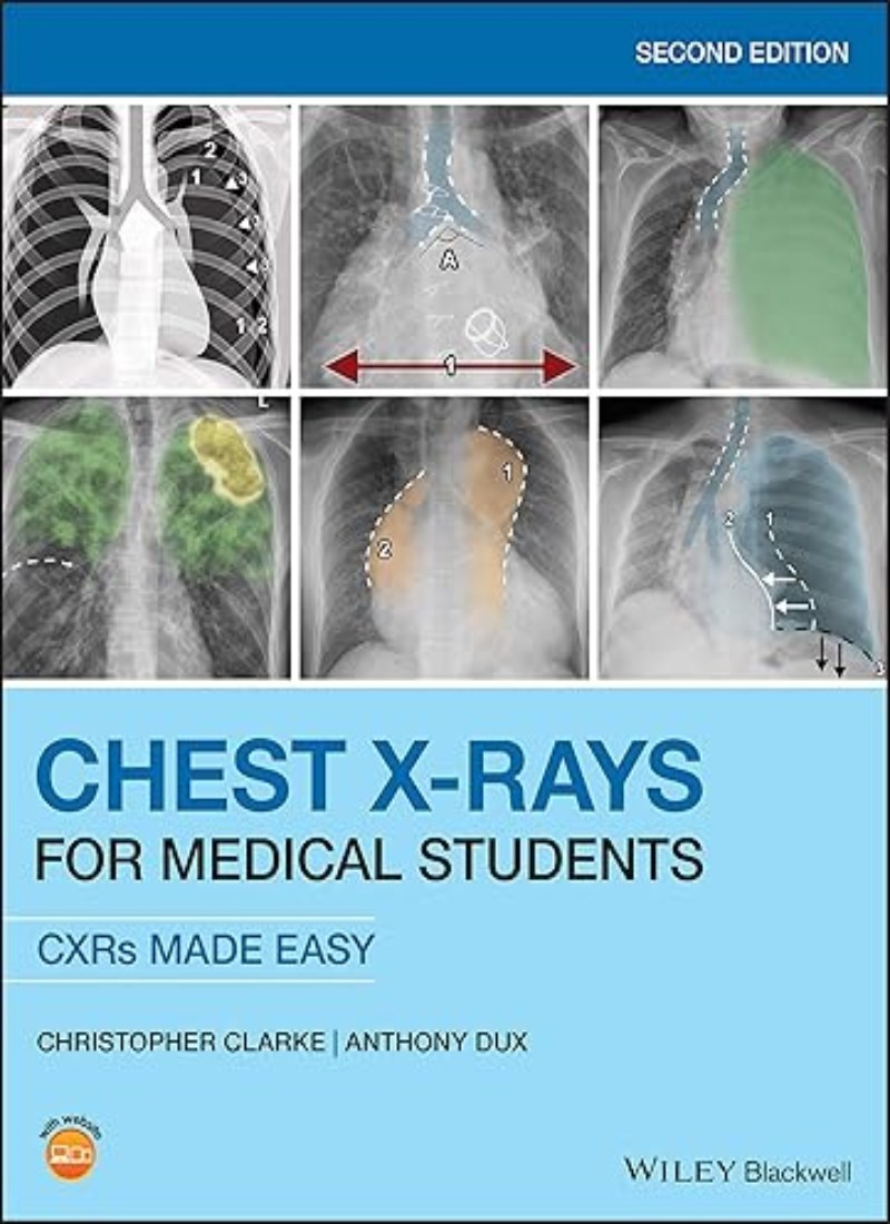 Chest X-Rays for Medical Students main 1 1