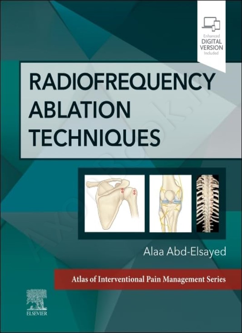 Radiofrequency Ablation Techniques Model.Title