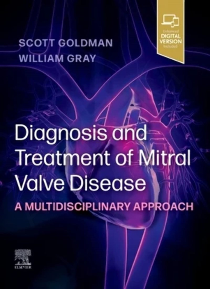 Diagnosis and Treatment of Mitral Valve Disease: A Multidisciplinary Approach main 1 1