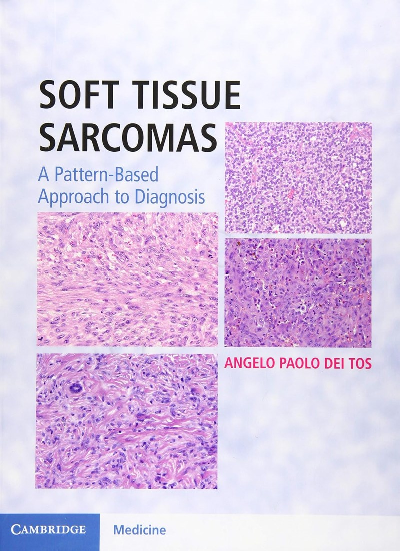 Soft Tissue Sarcomas Hardback with Online Resource: A Pattern-Based Approach to Diagnosis Model.Title