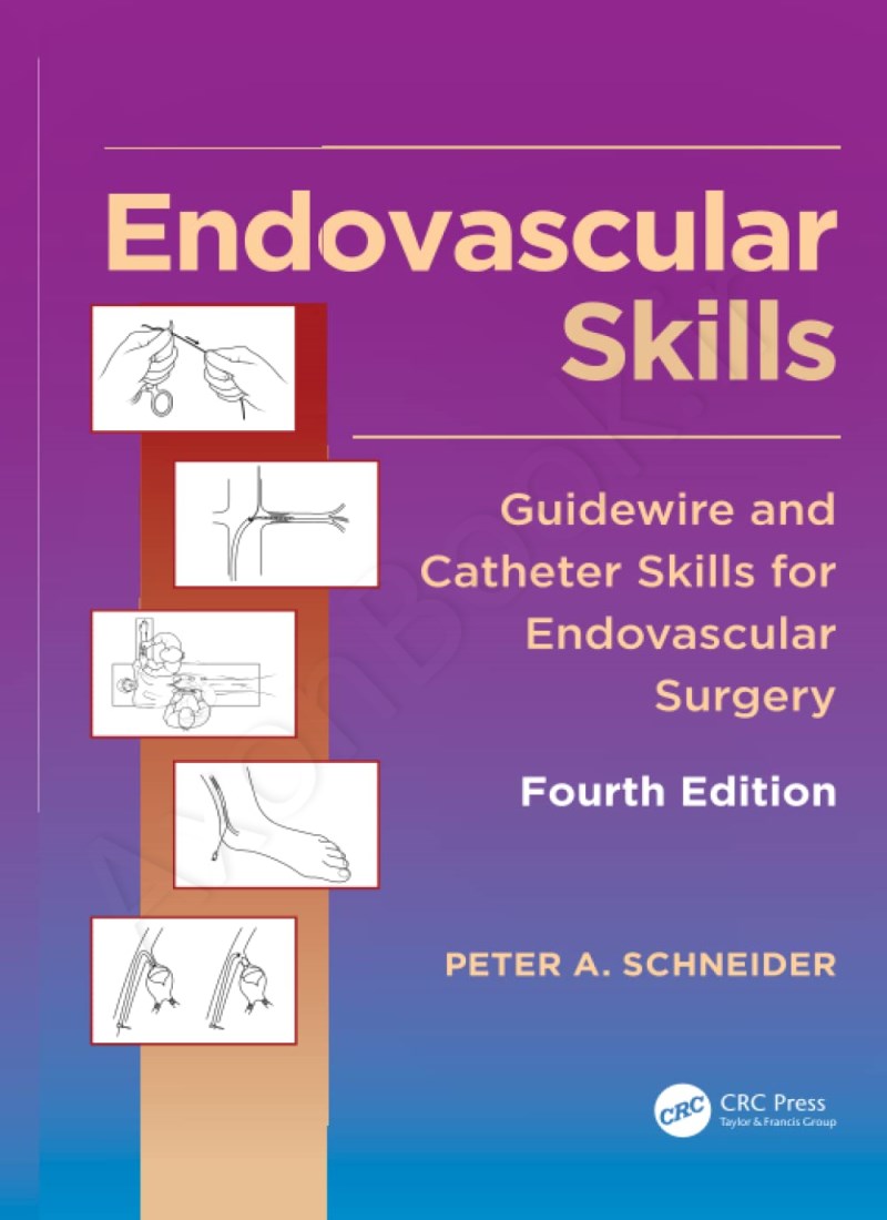 Endovascular Skills main 1 1