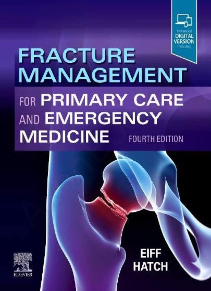 Fracture Management for Primary Care and Emergency Medicine main 1 1