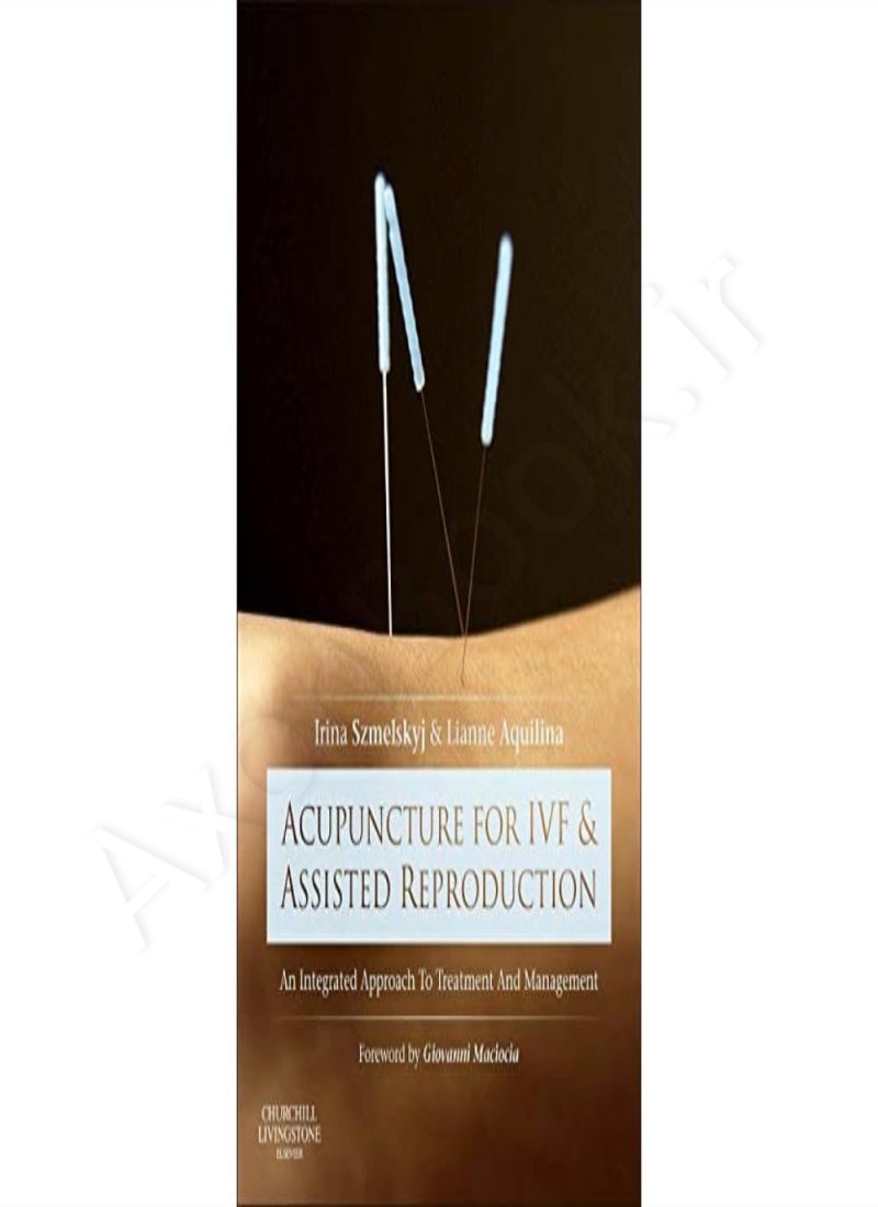 Acupuncture for IVF and Assisted Reproduction main 1 1