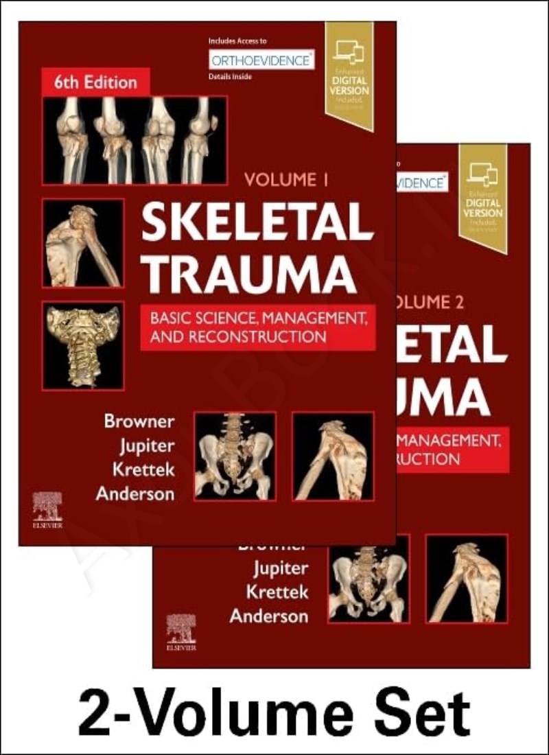 Skeletal Trauma 2-Volume main 1 1