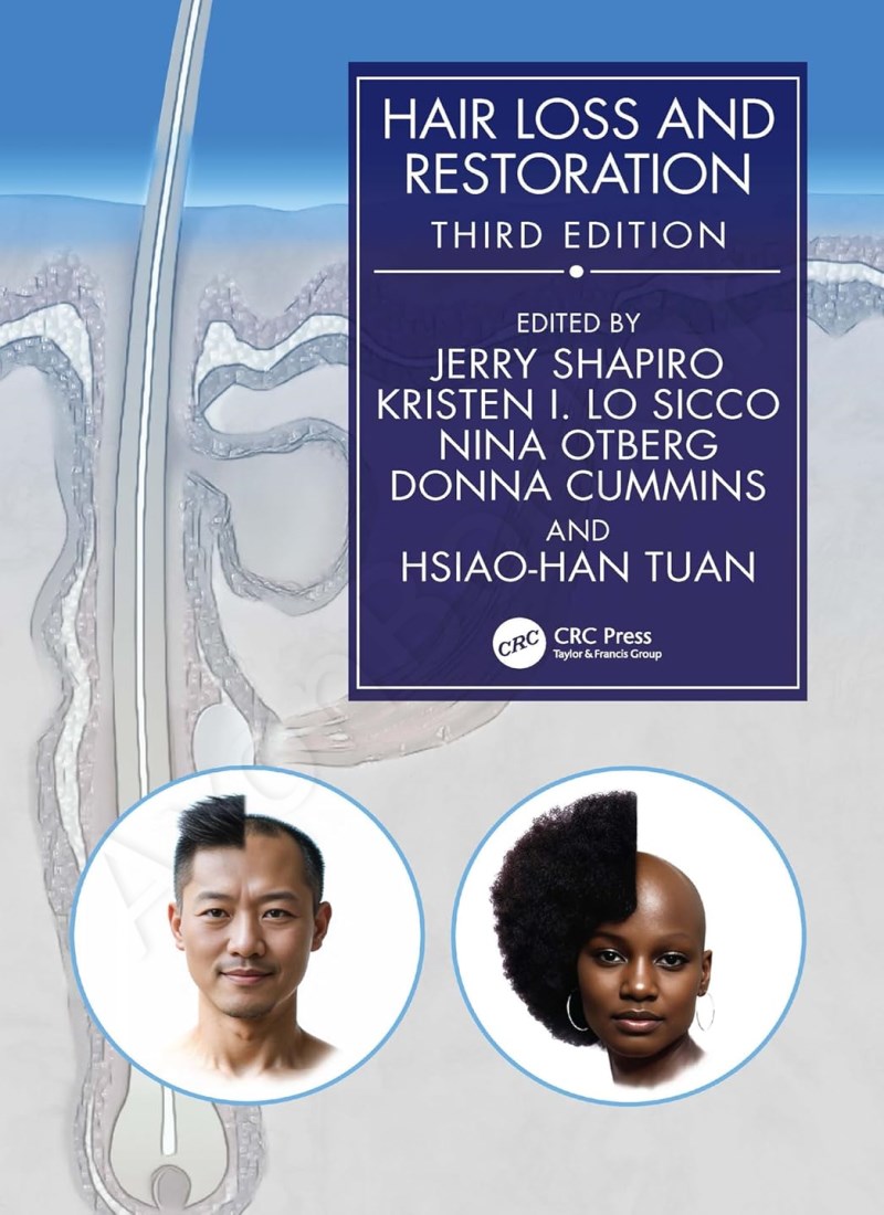 Hair Loss and Restoration 3rd Edition main 1 1