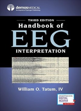Handbook of EEG Interpretation Handbook of EEG Interpretation thumb 2 1