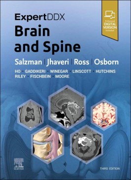 ExpertDDx: Brain and Spine thumb 2 1