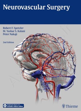 Neurovascular Surgery thumb 2 1