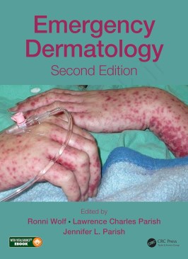 Emergency Dermatology thumb 2 1