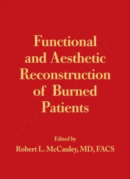 Functional and Aesthetic Reconstruction of Burned Patients thumb 2 1