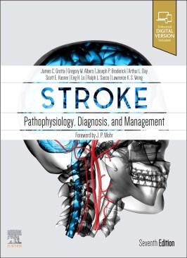 Stroke: Pathophysiology, Diagnosis, and Management thumb 2 1