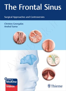 The Frontal Sinus: Surgical Approaches and Controversies thumb 2 1