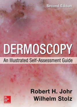 Dermoscopy: An Illustrated Self-Assessment Guide 2nd Edition thumb 2 1
