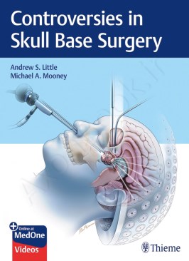 Controversies in Skull Base Surgery Controversies in Skull Base Surgery thumb 2 1