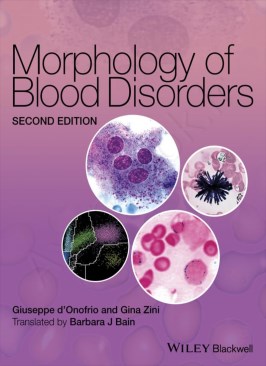 Morphology of Blood Disorders thumb 2 1