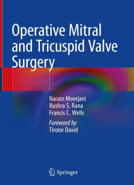 Operative Mitral and Tricuspid Valve Surgery thumb 2 1
