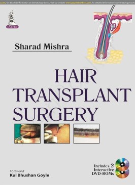 Hair Transplant Surgery Hair Transplant Surgery thumb 2 1