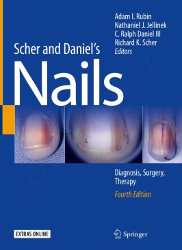 Scher and Daniel's Nails: Diagnosis, Surgery, Therapy Scher and Daniel's Nails: Diagnosis, Surgery, Therapy thumb 2 1