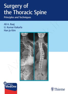 Surgery of the Thoracic Spine: Principles and Techniques thumb 2 1