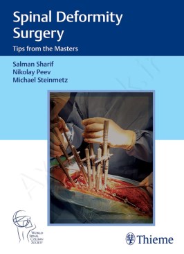 Spinal Deformity Surgery: Tips from the Masters Spinal Deformity Surgery: Tips from the Masters thumb 2 1