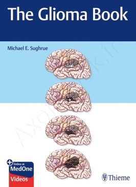 The Glioma Book thumb 2 1