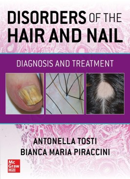 Disorders of the Hair and Nail: Diagnosis and Treatment Disorders of the Hair and Nail: Diagnosis and Treatment thumb 2 1