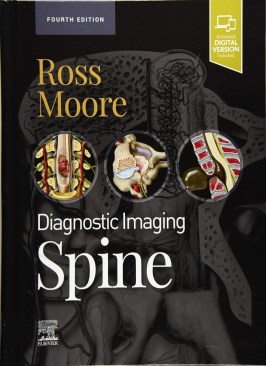 Diagnostic Imaging: Spine thumb 2 1