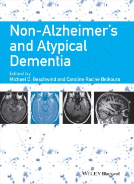 Non-Alzheimer's and Atypical Dementia Non-Alzheimer's and Atypical Dementia thumb 2 1