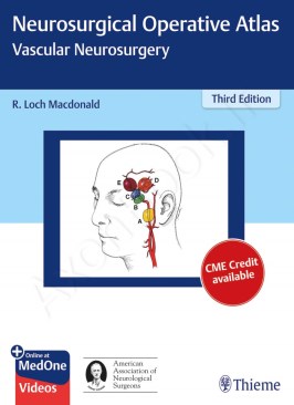 Neurosurgical Operative Atlas: Vascular Neurosurgery thumb 2 1