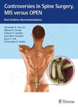 Controversies in Spine Surgery, MIS versus OPEN: Best Evidence Recommendations Controversies in Spine Surgery, MIS versus OPEN: Best Evidence Recommendations thumb 2 1