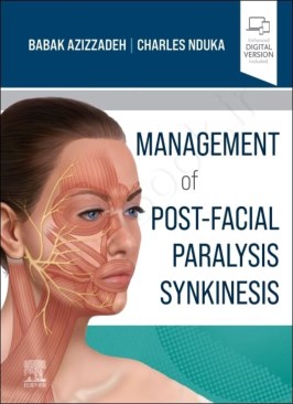 Management of Post-Facial Paralysis Synkinesis Management of Post-Facial Paralysis Synkinesis thumb 2 1