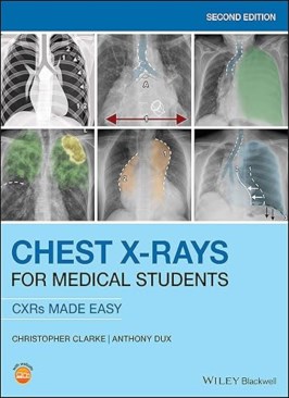 Chest X-Rays for Medical Students Chest X-Rays for Medical Students thumb 2 1