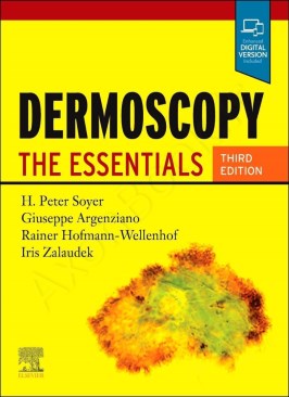 Dermoscopy E-Book: The Essentials Dermoscopy E-Book: The Essentials thumb 2 1