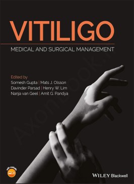 Vitiligo: Medical and Surgical Management thumb 2 1
