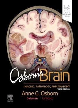 Osborn's Brain Osborn's Brain thumb 2 1
