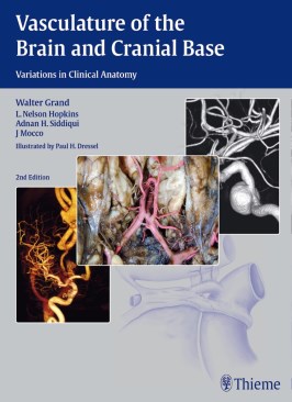 Vasculature of the Brain and Cranial Base thumb 2 1