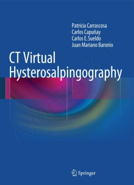 CT Virtual Hysterosalpingography thumb 2 1