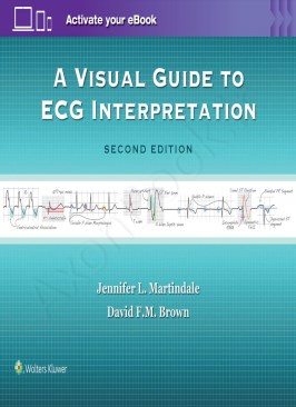 A Visual Guide to ECG Interpretation Second Edition thumb 2 1