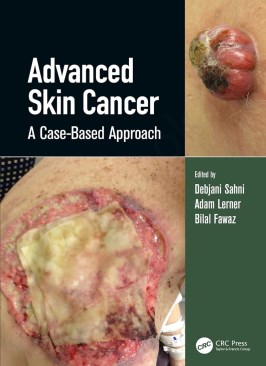 Advanced Skin Cancer: A Case-Based Approach thumb 2 1