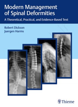 Modern Management of Spinal Deformities: A Theoretical, Practical, and Evidence-Based Text Modern Management of Spinal Deformities: A Theoretical, Practical, and Evidence-Based Text thumb 2 1