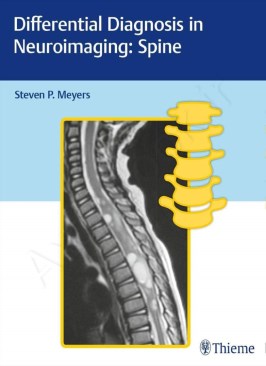 Differential Diagnosis in Neuroimaging: Spine thumb 2 1